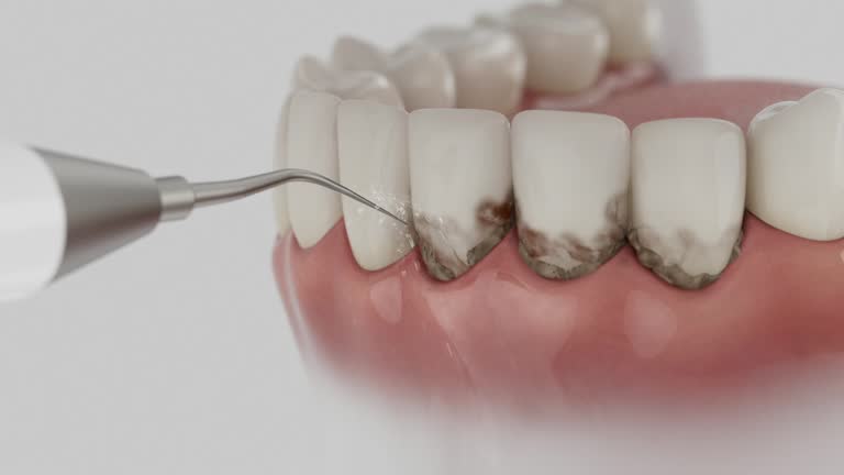 Trusted Dental Implants service in Heyworth, IL - Dentist Open Now